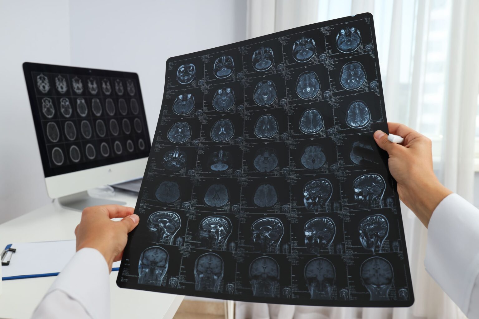 mri-images-of-a-human-head-in-the-hands-of-a-docto-2025-03-24-14-52-22-utc