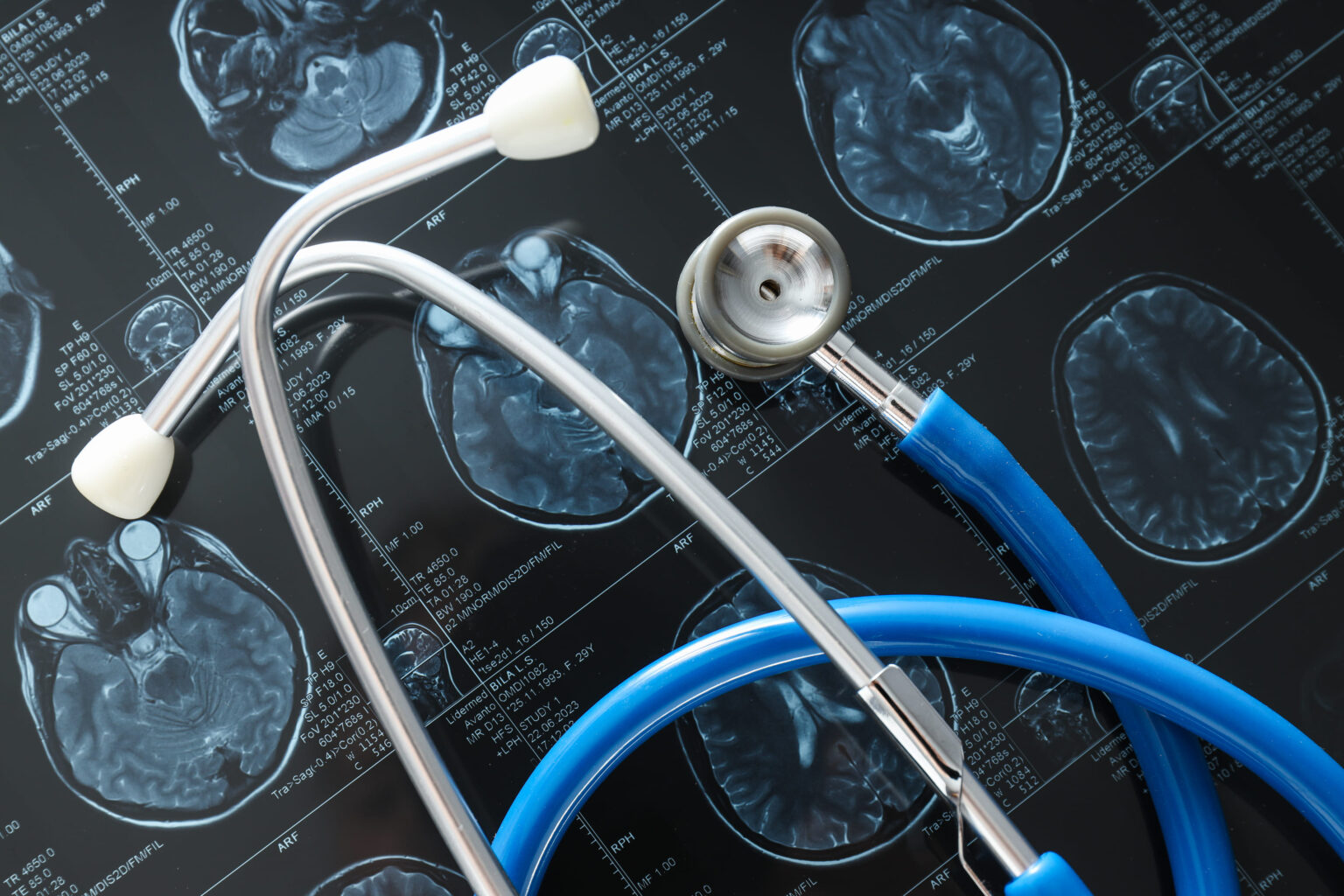 mri-or-magnetic-resonance-imaging-of-the-head-and-2025-03-25-02-08-47-utc