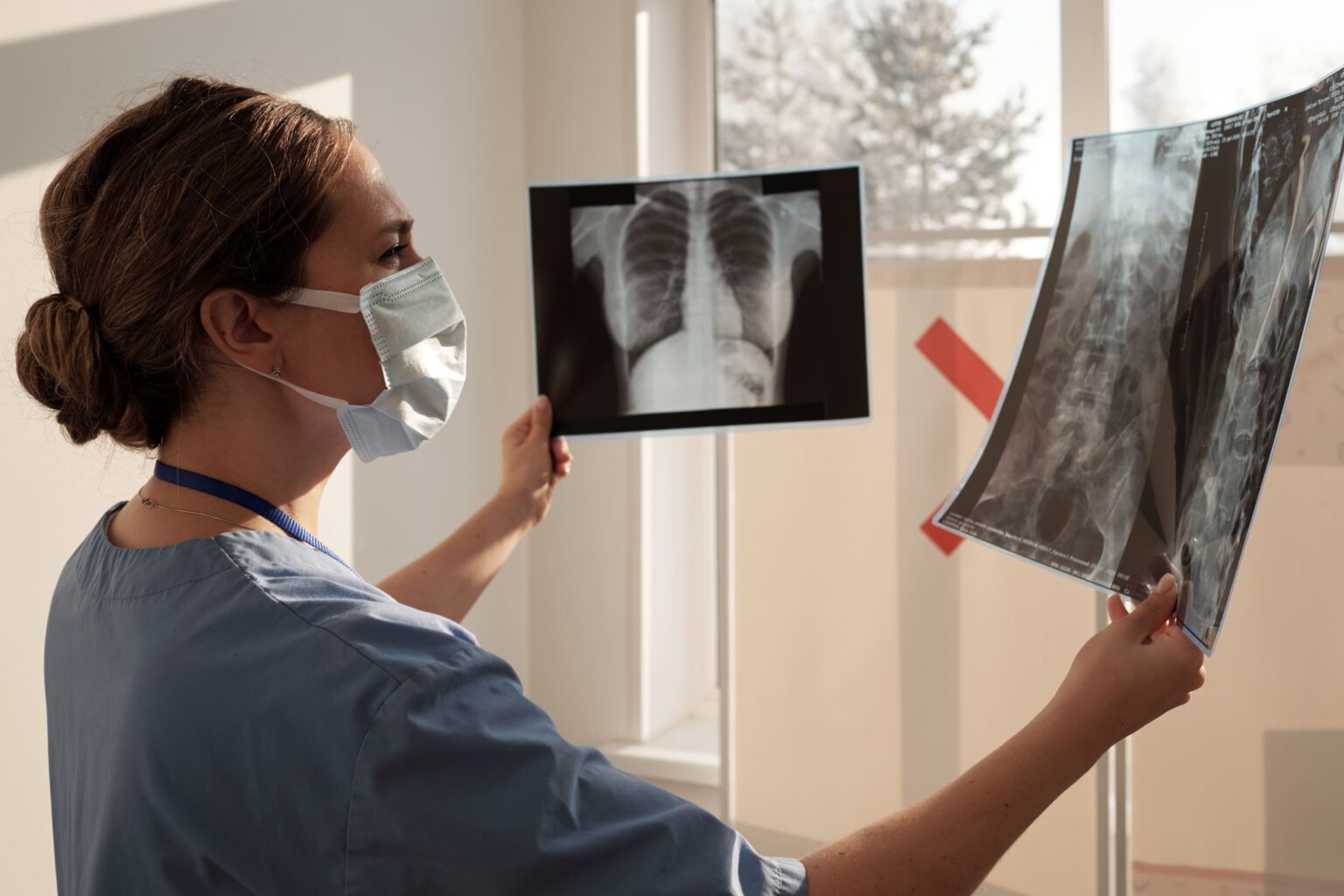young-nurse-or-radiologist-comparing-two-x-ray-ima-2025-03-14-14-32-11-utc